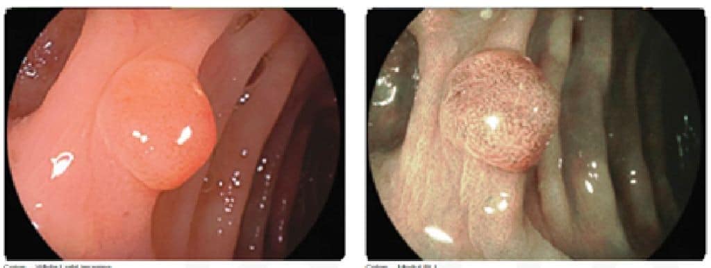 endoscopie-amamed endoscopie amamed ramnicu sarat