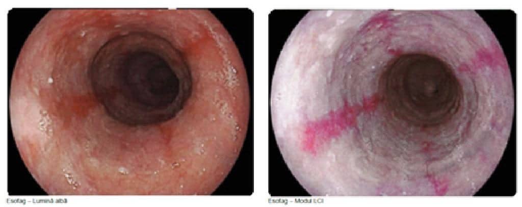 endoscopie_amamed endoscopie amamed buzau